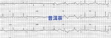 心律失常能喝茶叶吗-心律失常能喝茶叶吗女性