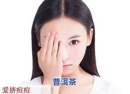 茶叶水能经常洗脸吗？对女性肌肤有何影响？