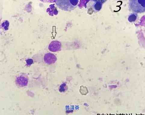 探索茶叶泡在水里的形态特征：从最初的干瘪到丰富的变化过程