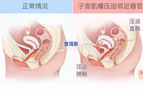 喝茶叶能改善口臭吗？女性、女生都适用，科学解析