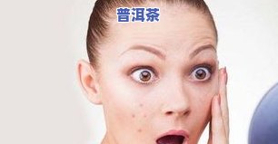 痤疮可以喝茶叶水吗？脸上长痤疮能喝茶吗？