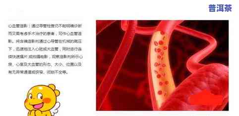 阿索普洱茶图片大全高清图，【高清图】探寻阿索普洱茶的魅力，一图看尽所有品种！