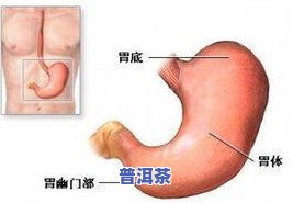 胃难受可以喝茶叶吗？女性适用的解决方案