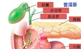 胃炎能否饮用茶叶茶水？探讨其影响因素与适宜人群