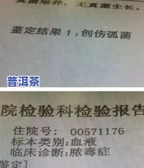 普洱茶细菌：检测报告显示其数量众多，是不是作用卫生与口感？