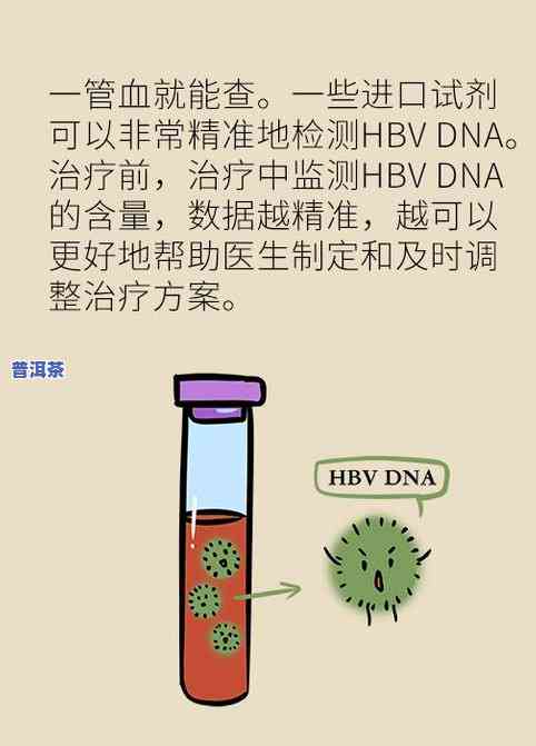 暴食后喝绿茶有用吗？科学解析与实证效果