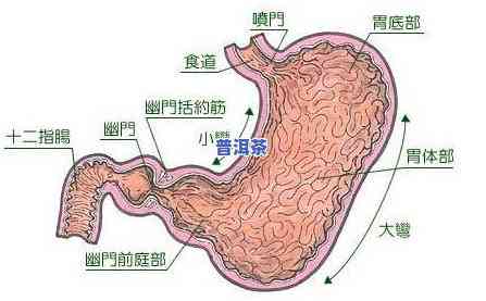 为何喝普洱茶会引发胃部不适、恶心？如何解决这个问题？