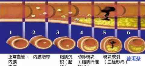 普洱茶泡出来颜色为什么有点发黑？作用因素与品质关系解析