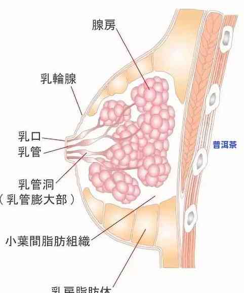 胃溃疡能喝茶叶水吗？好处与注意事项