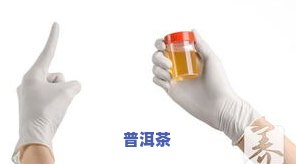 尿液茶叶色是疾病征兆吗？熟悉其起因与作用