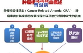 小便呈茶叶色的原因及正常性分析