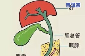 喝普洱茶对胆囊炎的影响：好处与注意事项