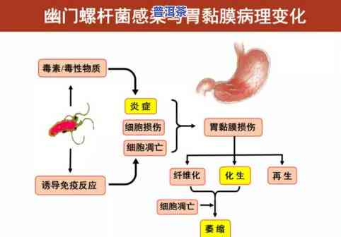 普洱茶促消化的原理和作用详解：真相大揭秘！