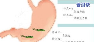 消除幽门杆菌的茶叶-消除幽门杆菌的茶叶有哪些