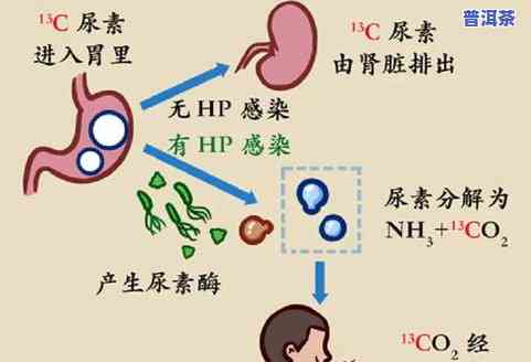 治幽门螺杆菌的茶叶是什么？名称、种类全揭秘！