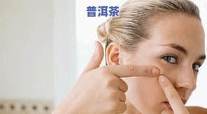 长痘痘的女生可以喝茶叶茶吗？熟悉作用与解决办法