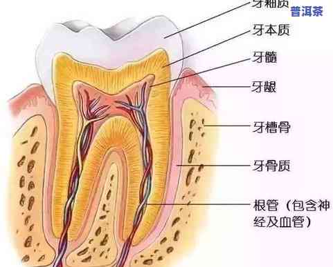 胆管炎可以喝茶叶水吗，关于胆管炎的治疗，能否通过喝茶叶水来缓解症状？