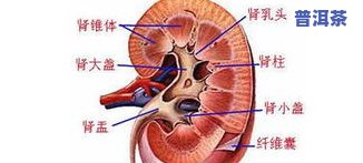 肾盂肾炎能喝普洱茶吗-肾盂肾炎能喝普洱茶吗女性