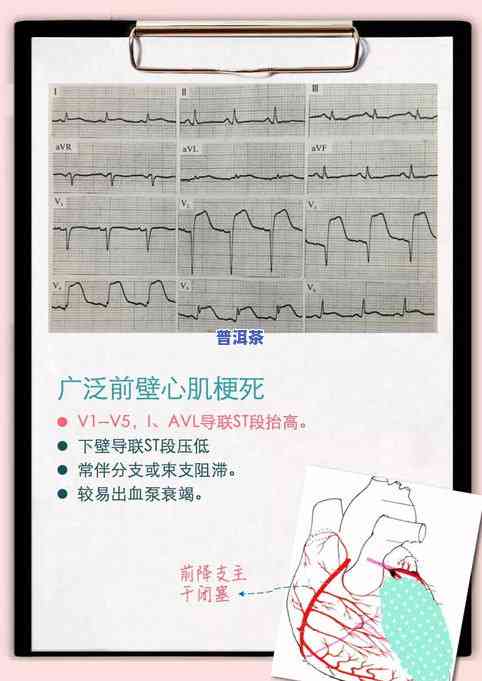 开茶叶店的经验全面报告与实用技巧