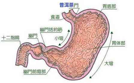 生普洱胃疼怎么办，解决生普洱引起的胃部不适：实用的缓解方法