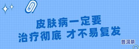 喝了普洱茶胃胀怎么缓解，如何缓解喝普洱茶后引起的胃部不适？