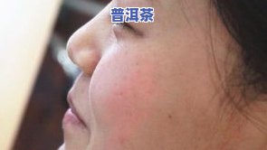 漂唇后可以喝普洱茶吗-漂唇后可以喝普洱茶吗女生