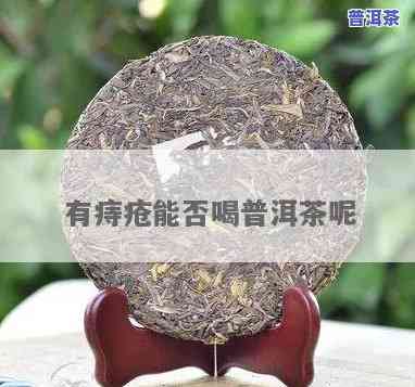 痔疮手术后可以喝普洱茶吗？术后女性适用吗？