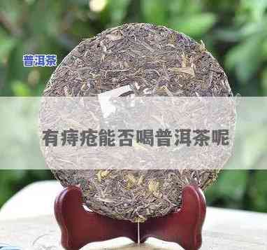 痔疮术后喝普洱茶-痔疮术后喝普洱茶好吗