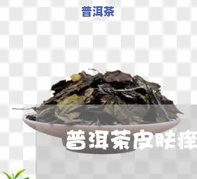 普洱茶喝后皮肤会痒吗？起因解析与疙瘩形成探讨