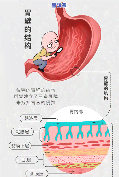 胃溃疡能不能喝普洱？探讨普洱茶对胃部的作用及适合人群