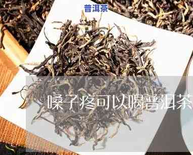 嗓子干痒喝普洱茶有用吗-嗓子干痒喝普洱茶有用吗女性