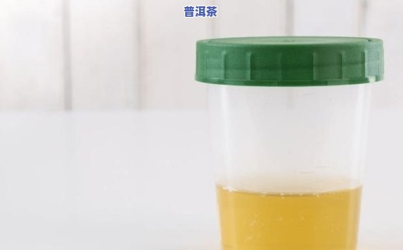 蛋白尿喝茶：有用吗？喝茶还是喝水？