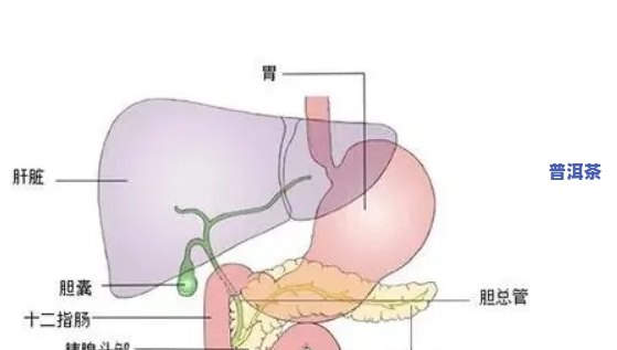 胆囊切除可以喝普洱茶吗，胆囊切除手术后，是不是适合饮用普洱茶？