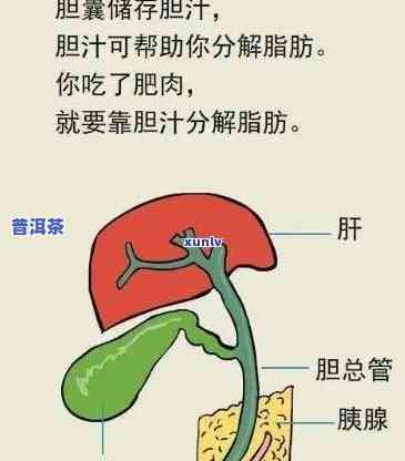 胆囊切除的人可以喝茶叶吗，胆囊切除患者能否安心饮用茶叶？