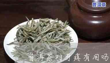 牙髓炎喝普洱茶有用吗女性-牙髓炎喝普洱茶有用吗女性可以喝吗