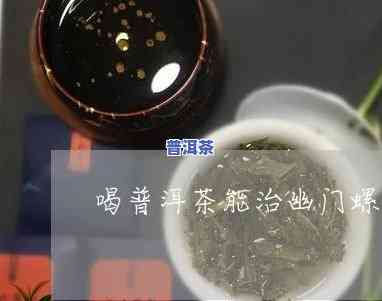 幽门螺杆菌喝普洱茶有用吗-幽门螺杆菌喝普洱茶有用吗女性