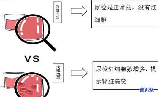 晚上喝普洱早上撒尿红：正常现象还是健康疑问？